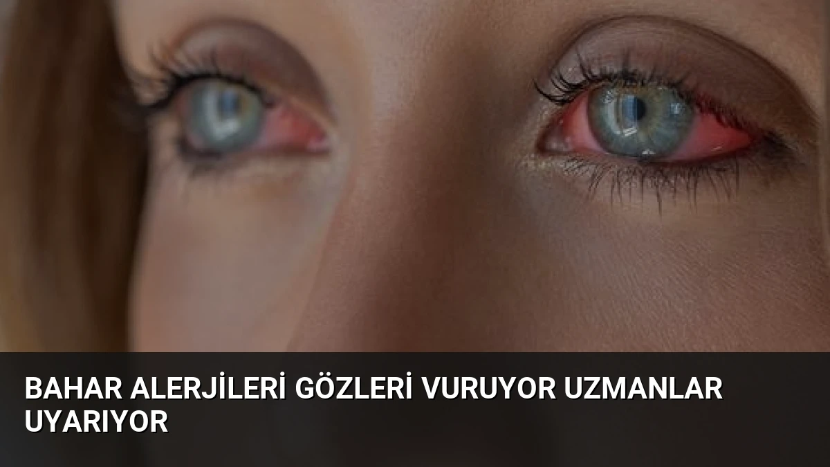 Bahar Alerjileri Gözleri Vuruyor Uzmanlar Uyarıyor