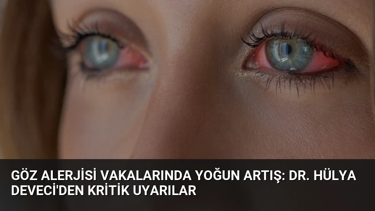 Göz Alerjisi Vakalarında Yoğun Artış: Dr. Hülya Deveci’den Kritik Uyarılar