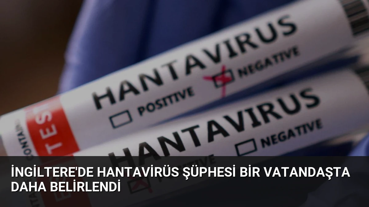 İngiltere’de Hantavirüs Şüphesi Bir Vatandaşta Daha Belirlendi